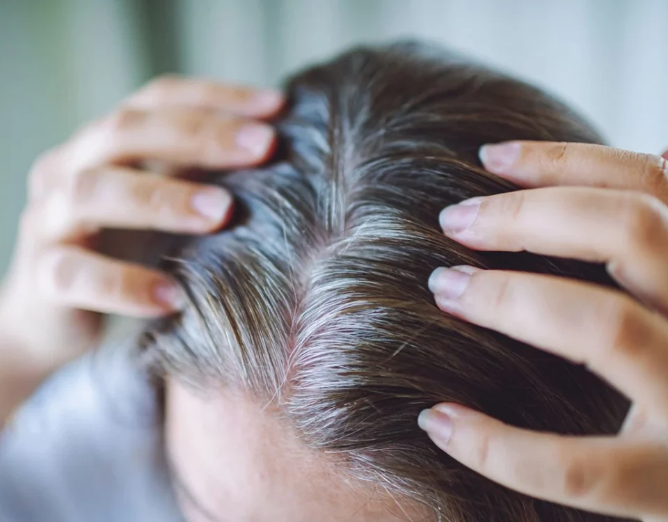 بهترین مرطوب کننده پوست سر